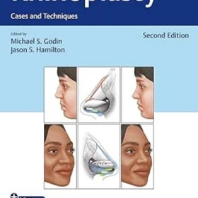 دانلود کتاب Rhinoplasty: Cases and Techniques 2nd Edition  + Video-جستینو